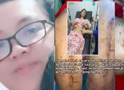 Olfit Ariani Purba, ASN BPK di Bogor, Dilaporkan Aniaya ART hingga Luka Parah