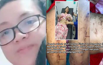 Olfit Ariani Purba, ASN BPK di Bogor, Dilaporkan Aniaya ART hingga Luka Parah